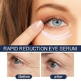 thumbnail image 5 of Sérum pour les Yeux à Réduction Rapide, Formule Avancée, Sérum Anti-Âge pour les Yeux, Réduit Visiblement les Poches, Rides, Foncé, 5 of 5