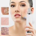 thumbnail image 2 of Portable Face Deep Nose Acne Cleaner Blackheads Vacuum Pore Remover Skin Care, 2 of 9