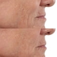 thumbnail image 6 of Perricone MD Vitamin C Ester CCC+ Ferulic Brightening Complex 20% Serum, 6 of 6