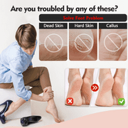 FVSA Nail Kit, 20 in 1 Pedicure Kit: Foot Scrub, Callus Remover, Cuticle Care, Toe Clippers, More for Manicure and Pedicure