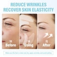 thumbnail image 6 of Smile Line Patches Anti Wrinkle Lip Strips, Upgraded Extra Adhesion Hydrogel, Overnight Facial Smoothing Pads for Nasolabial Folds, 160 Patches., 6 of 7