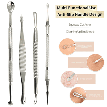 Pimple Popper Tools Kit, Blackhead Whitehead Remover Acne Comedone Extractor, 4 Pieces