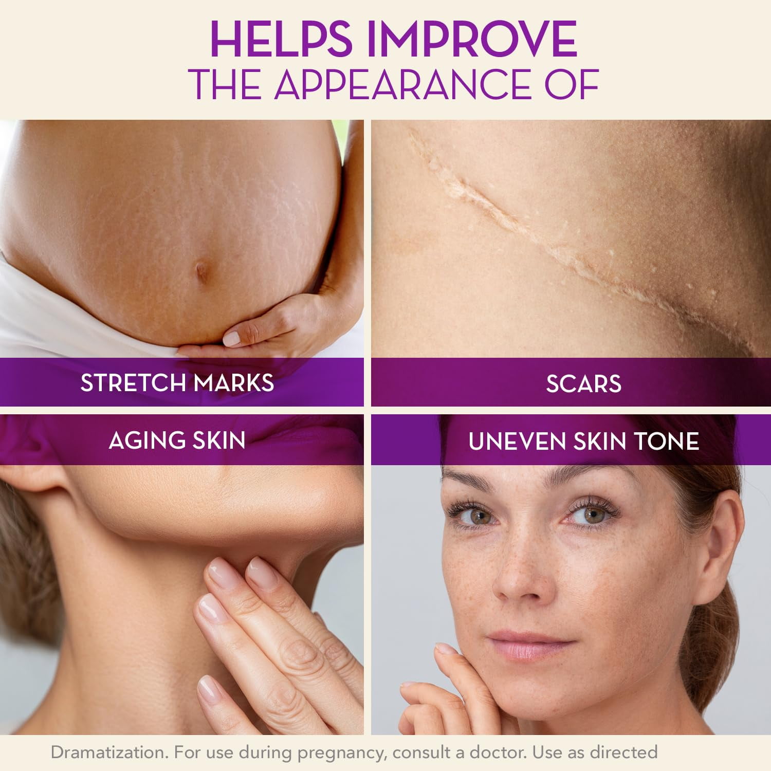 Cicatricure Cica Oil for Stretch Marks & Scars, Vitamin E Body Oil, Visible Results in 4 Weeks, 6.7 fl oz (3 Pack)