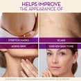 thumbnail image 4 of Cicatricure Cica Oil for Stretch Marks & Scars, Vitamin E Body Oil, Visible Results in 4 Weeks, 6.7 fl oz (3 Pack), 4 of 5