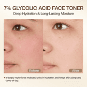 Glycolic Acid Toner Gently Exfoliating Reveals Smoother and Clearer Skin 240ml