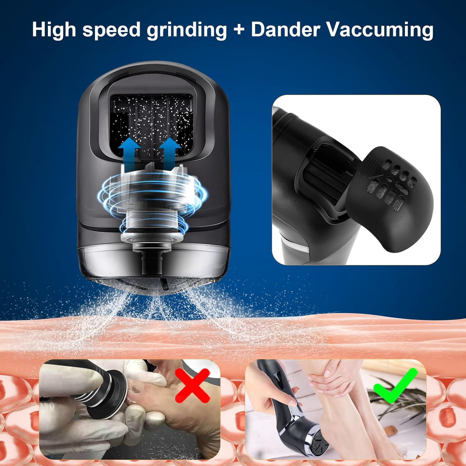 Aorsher 2-Speed Electric Foot Callus Remover with LCD Display, Dual Motors Rechargeable Calloused Feet Remover Tool Kit for Efficient Exfoliation of Dead Skin on Feet, IPX7 Waterproof
