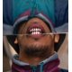 thumbnail image 2 of Gorras de Hip Hop chapadas en oro rosa, ajuste personalizado, conjunto de Grillz superior e inferior, parrillas para dientes, boca Hop, ajuste personalizado, Grillz de dientes pulidos, 2 of 5