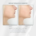 thumbnail image 3 of ($199 Value) UPBUTY UF07 Facial Contouring and Toning Device Anti-Aging Solution, 3 of 10