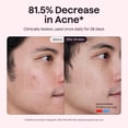 thumbnail image 4 of Mascarilla de terapia de luz roja wavytalk antiacné y antiedad, 4 of 9