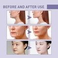 thumbnail image 2 of Waterproof Face Lifting Tape Firming Facial Skin Anti-wrinkle Fading Fine Lines V Face Invisible Lifting Firming Tap, 2 of 5