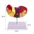 thumbnail image 2 of Modelo de Hígado para Patologías Comunes, Modelo de Hígado, Modelo de Anatomía de Consultorio de Anatomía, 2 of 6