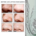 thumbnail image 4 of Jaysuing Blackhead Removal Essence Moisturizes And Tightens The Skin, Shrinks Pores, Deeply Cleans And Removes Blackheads |, 4 of 5