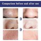 thumbnail image 4 of Jaysuing Deep Pore Cleansing Paste Deep Cleansing Nose Blackhead Closed Mouth Firming Pore Care Nasal Sticker - 6Pcs, 4 of 4