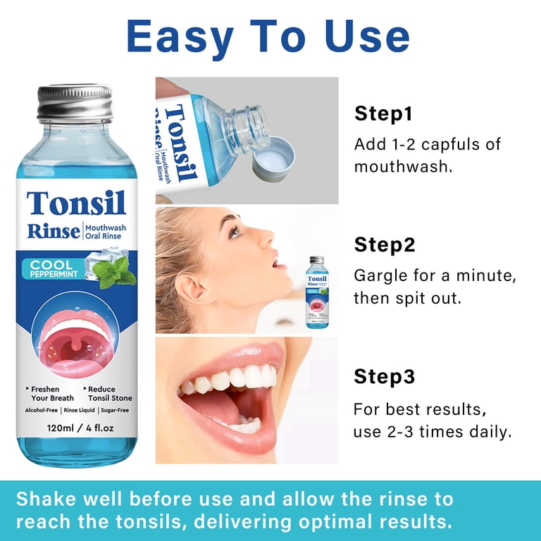 Does Mouthwash Help With Tonsil Stones? The Truth Revealed