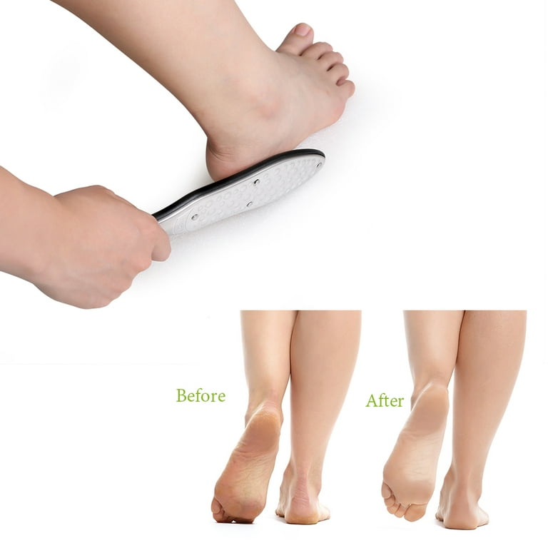 Feet Callus Shaver Professional Foot Scraper Sturdy Foot Hard Skin