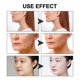 thumbnail image 4 of Parche de estiramiento facial Fiudx con semillas de melón en forma de V, 4 of 7