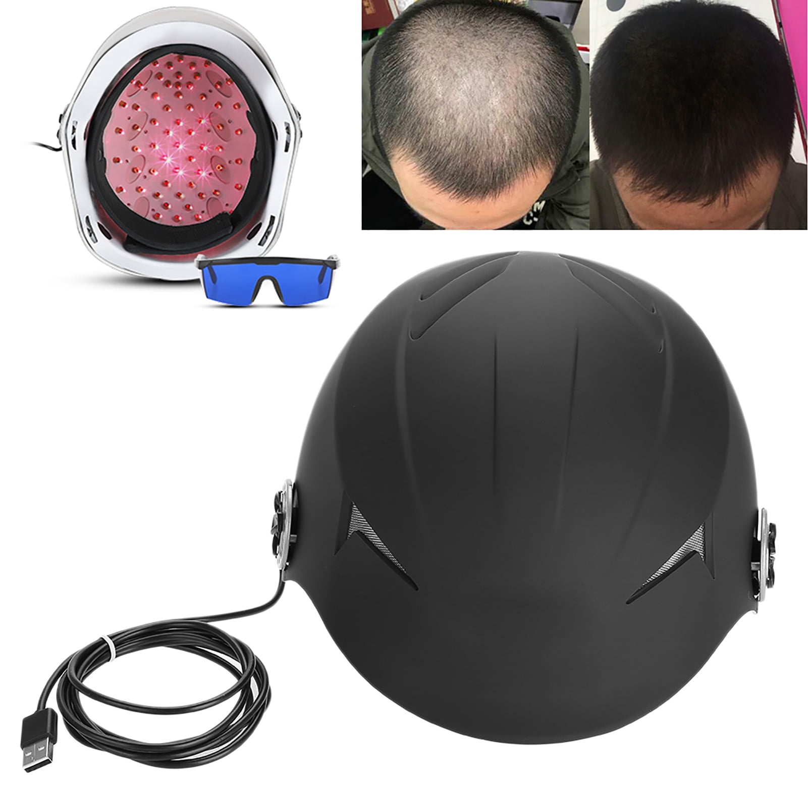 Hair Diode , Hair Loss Solution Hair Diode Helmet, Hair Regrow Helmet
