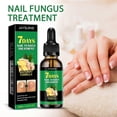 thumbnail image 2 of JAYSUING Ginger Nail Growth Solution 30ml 7 Days Nail Treatment for Strengthen & Promote Nail Gr, 2 of 5