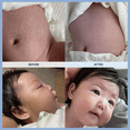 thumbnail image 2 of Mongdies Baby Ato Cream | 200 Hour Long Lasting Hydration | Patented Ceracine™ & 6 Layer Ceramide Barrier Care | Intensive Moisturizer for Dry & Sensitive Skin | Dermatologist Tested | 8.11 fl oz, 2 of 9