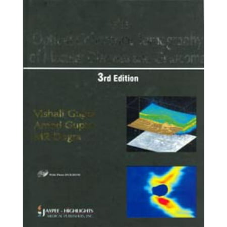 Atlas Optical Coherence Tomography of Macular Diseases and Glaucoma, 3rd Edition with DVD ROM, Used [Hardcover]