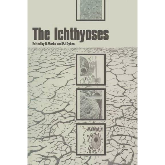 The Ichthyoses: Proceedings of the 2nd Annual Clinically Orientated Symposium of the European Society for Dermatological, (Paperback)