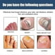 thumbnail image 4 of South moon onychomycosis repair spray moisturizes and cleans odor onychomycosis soft nail dry na, 4 of 5