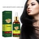 thumbnail image 1 of Suero Para El Del Cabello De Jengibre De 30ml, Aceite Para El Del Cabello Para Detener La Caída Del Cabello Para Hombres Y Mujeres Yinane Sérum para el crecimiento del cabello de jengibre, 1 of 8