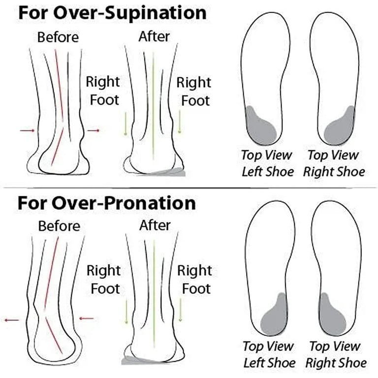Bohemian Fashion Non Slip Orthopedic Sandals Fashion Shoes
