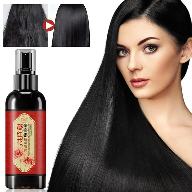 Fiudx Spray Capilar, Tratamiento Nutritivo para El Cuero Cabelludo, Fórmula Potenciadora de La Elasticidad, Solución Anticaspa, Vitalidad Capilar Diaria, para Todo Tipo de Cabello, Spray de Polygonum