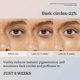 thumbnail image 5 of Advanced Retinol Ferulicacid Eye Cream Stick Fade Fine Lines Eye Compact Wrinkle Hydrating And Moisturizing 7g, 5 of 9