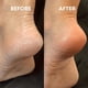 thumbnail image 5 of Lima de vidrio para pies para eliminar callos | Exfoliante de piel muerta para talones y pies | Herramienta suave para pedicura en seco y húmedo | Portátil y fácil de limpiar | Ideal para viajes, 5 of 9
