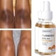 thumbnail image 1 of Suero corrector de manchas oscuras de cúrcuma, suero facial reparador de cúrcuma para tratamiento facial de Melasma, 2 uds., 1 of 5