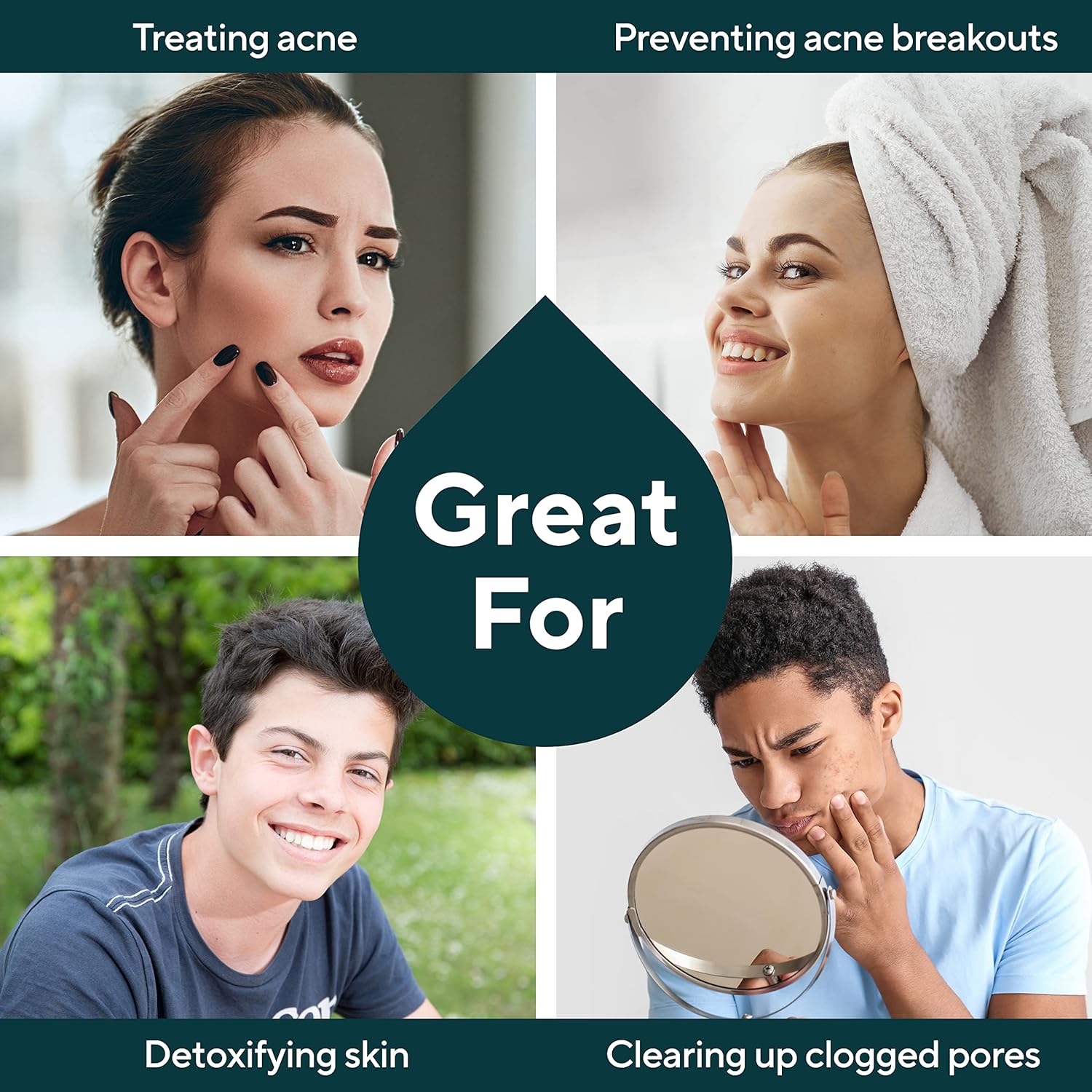 Marie Originals Acne Bar Soap Cleanser for Face and Body, Acne Treatment with Bentonite Clay - 6 pack