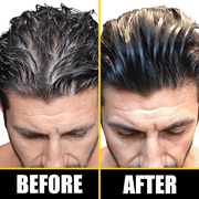 Pete & Pedro BOOST Hair & Beard Growth Strengthening Serum With Biotin & Rosemary, 2 oz