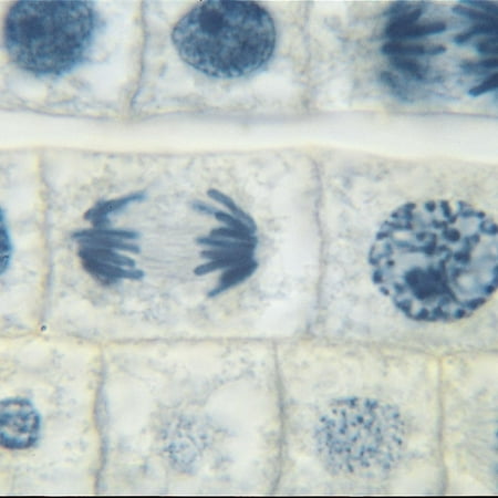 Ascaris And Onion Mitosis Microscope Slide Set price history on PriceWatchPro