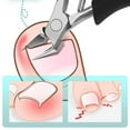 thumbnail image 3 of Ingrown Toenail Clippers Stainless Steel Nail Cutter Pedicure Manicure Tool, 3 of 16