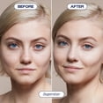 thumbnail image 2 of Corrector ALLEYOOP Game Face Superstar Lightweight Medium, 2 of 8