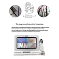 thumbnail image 4 of MEIBOYI 11 Inch LCD Skin Hair Scalp Analyzer Detector Digital Microscope Magnifier Skin Hair Blackhe, 4 of 5