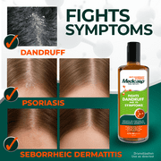 Medicasp Coal Tar Dandruff Shampoo for Dandruff, Seborrheic Dermatitis and Psoriasis, 6 fl oz