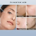 thumbnail image 2 of La Solution Ordinaire à l'Acide Salicylique 2 %, une Solution Exfoliante 30ml, 2 of 5
