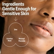 Cetaphil Gentle Clear Complexion-Clearing BPO Acne Cleanser for Sensitive Skin, 4.2 fl oz