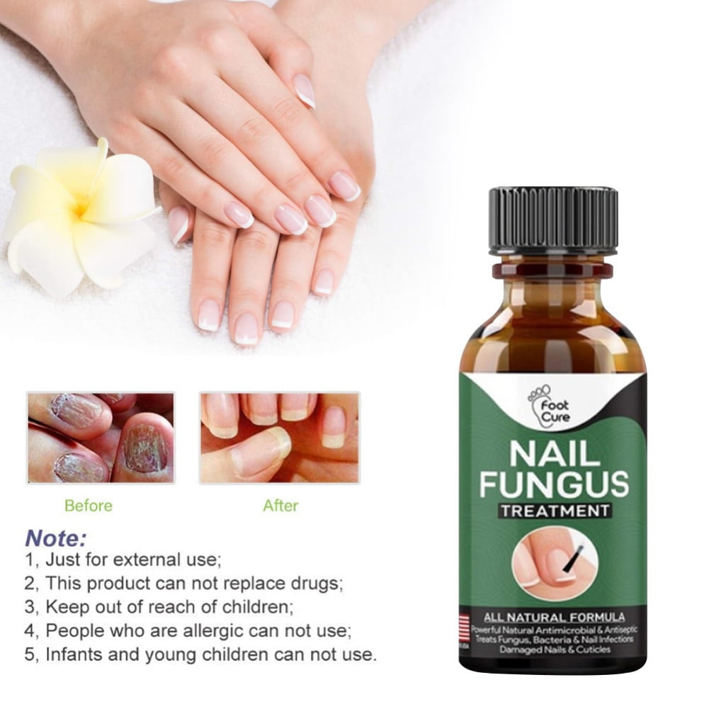 15 home remedies for toenail fungus | SingleCare