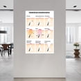 thumbnail image 2 of Evolution of Acne And Scar Formation Skin Anatomy Beauty Posters Canvas Painting Posters And Prints Wall Art for Living Room Bedroom Decor, 2 of 4