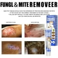 Treatment Ringworm Mites AntiItch Cream Fight Ringworm Infections For