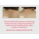 thumbnail image 2 of Crema hidratante ATOPALM Intensive para pieles secas y sensibles, 2 of 5