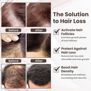 Copper Peptide Hair Growth Treatment GHK-cu, AHK-cu, Licorice Root Extract, Ginseng Root Extact