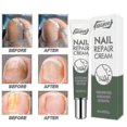 thumbnail image 1 of Crema para onicomicosis Eliminación rápida de onicomicosis Manicura Uñas, 1 of 3