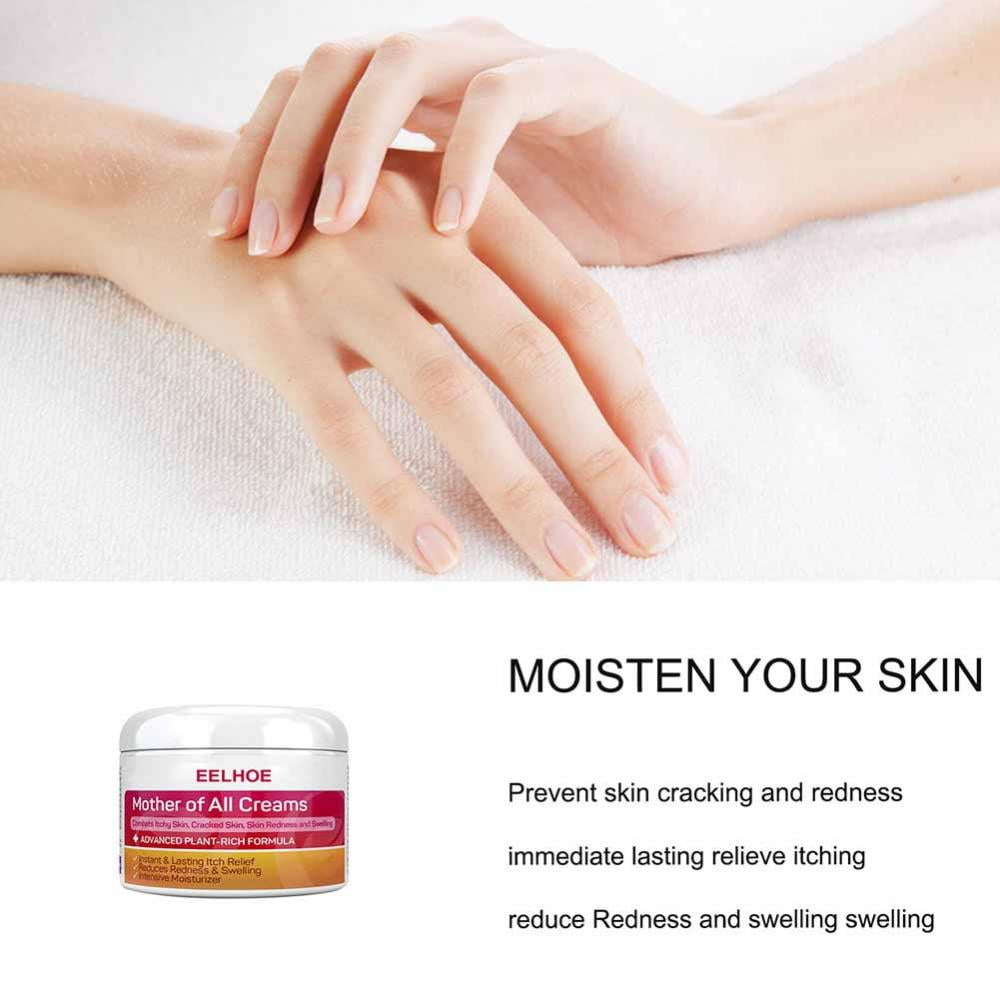 Skin Psoriasis Cream Dermatitis Eczematoid Eczema Treatment Psoriasis Skin Care Skin Psoriasis Cream Dermatitis Eczematoid Eczema Treatment Psoriasis Skin Care