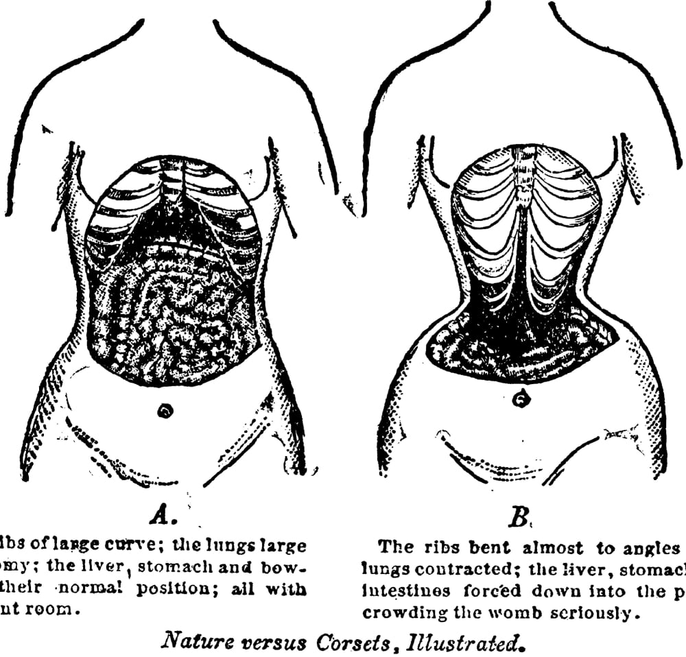 Nature Versus Corsets At Left Is The Natural Arrangement Of A WomanS