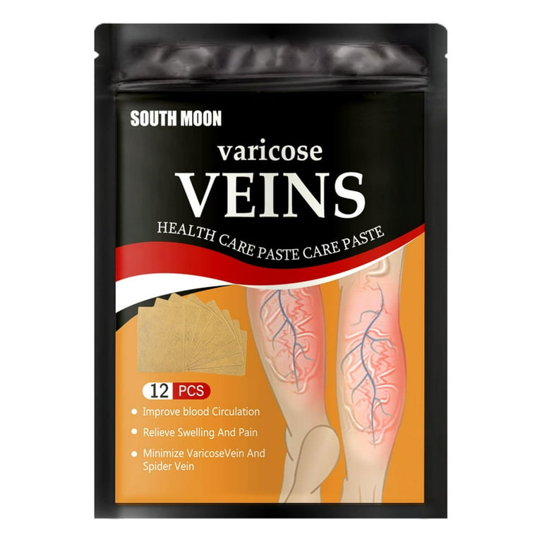 12 Tips + Tricks to Treat Varicose Veins